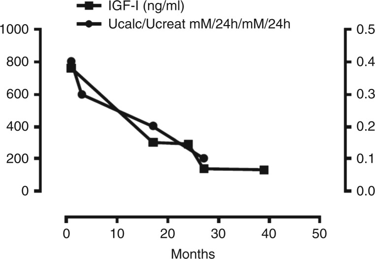 Vanishing hypercalciuric kidney stones after treating underlying acromegaly.