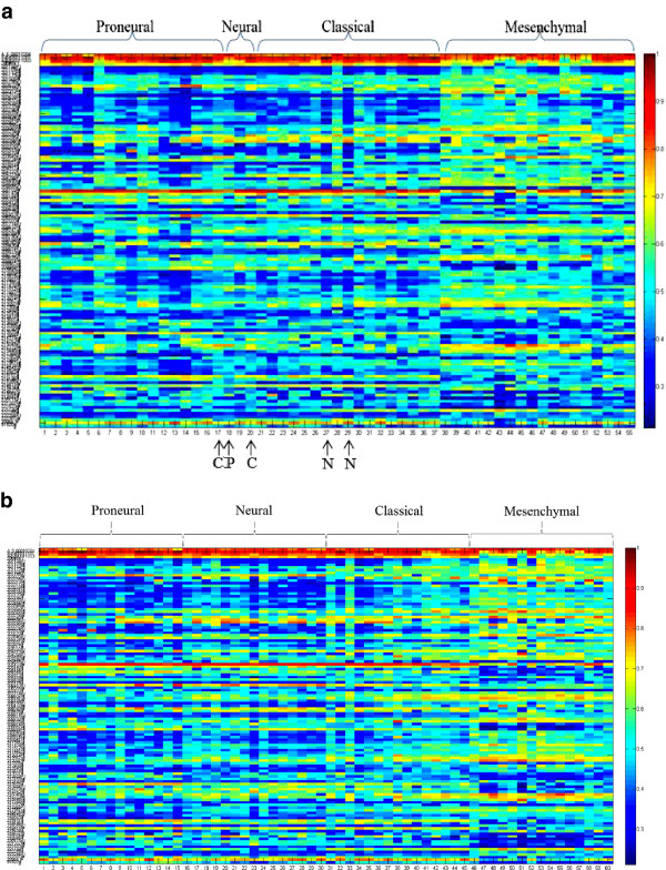 Subtyping glioblastoma by combining miRNA and mRNA expression data using compressed sensing-based approach.