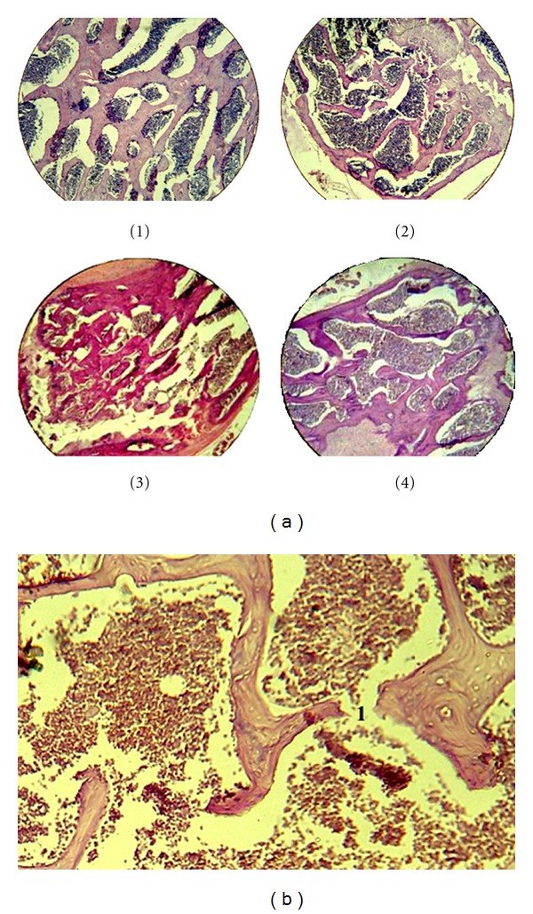 Comparative evaluation of enalapril and losartan in pharmacological correction of experimental osteoporosis and fractures of its background.