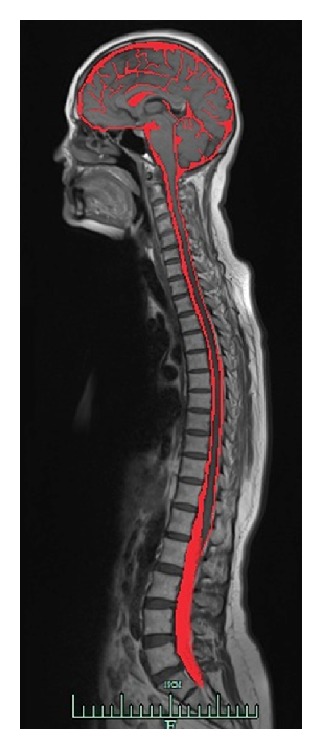 The maze of the cerebrospinal fluid discovery.