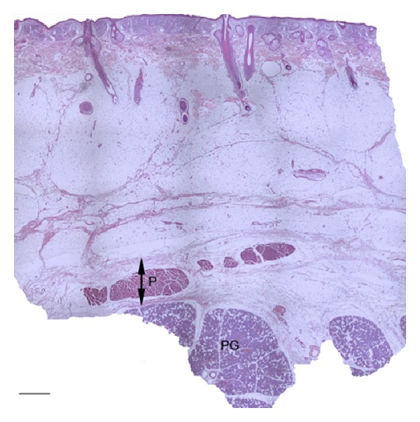 The superficial musculoaponeurotic system of the face: a model explored.