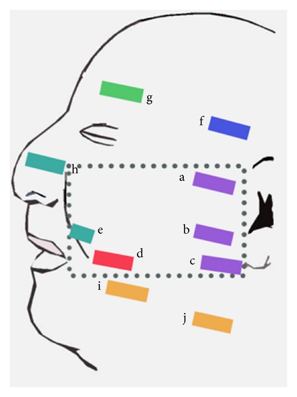 The superficial musculoaponeurotic system of the face: a model explored.