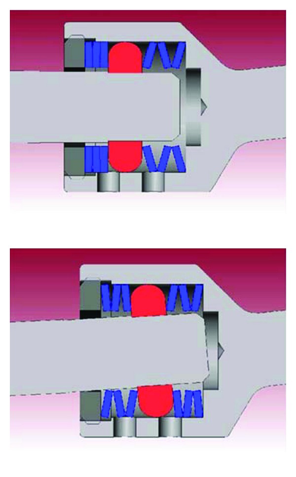 Pedicle-Screw-Based Dynamic Systems and Degenerative Lumbar Diseases: Biomechanical and Clinical Experiences of Dynamic Fusion with Isobar TTL.