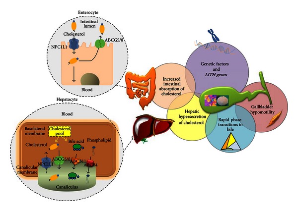 Current views on genetics and epigenetics of cholesterol gallstone disease.