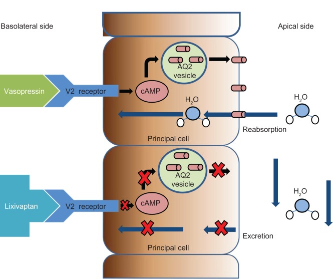 Lixivaptan - an evidence-based review of its clinical potential in the treatment of hyponatremia.