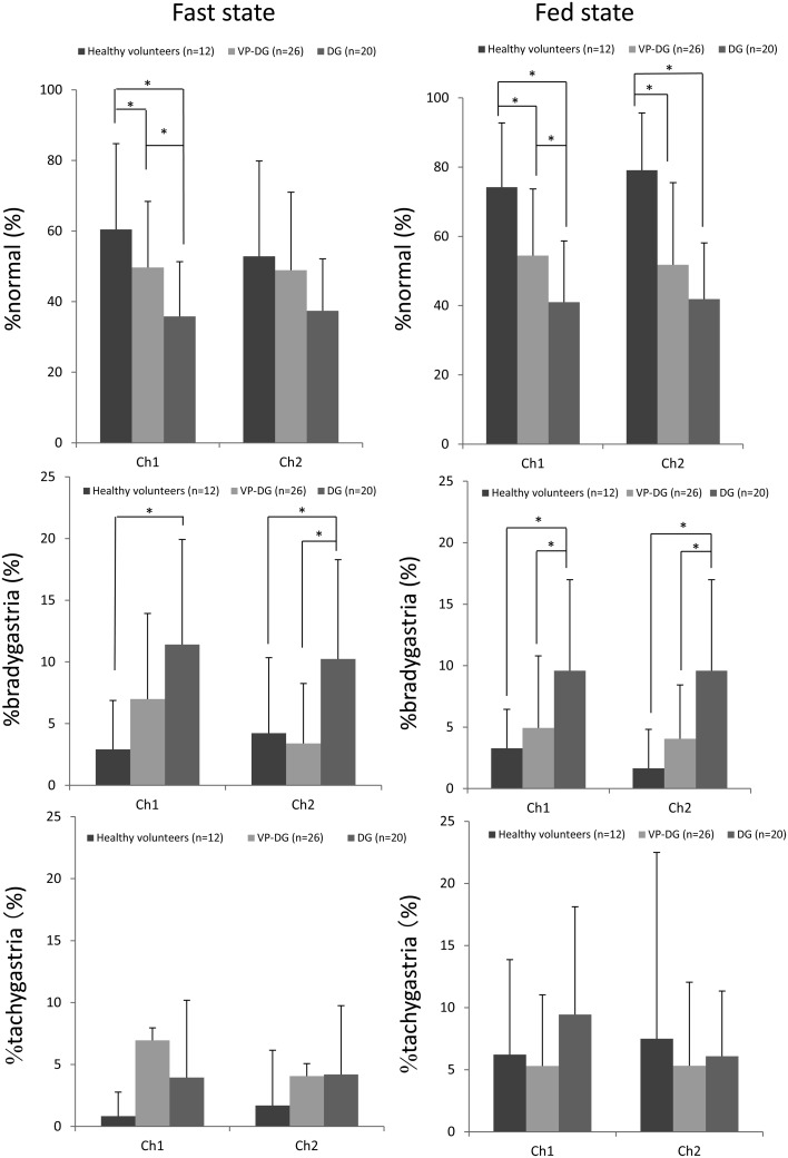 Evaluation of electrical activity after vagus nerve-preserving distal gastrectomy using multichannel electrogastrography.