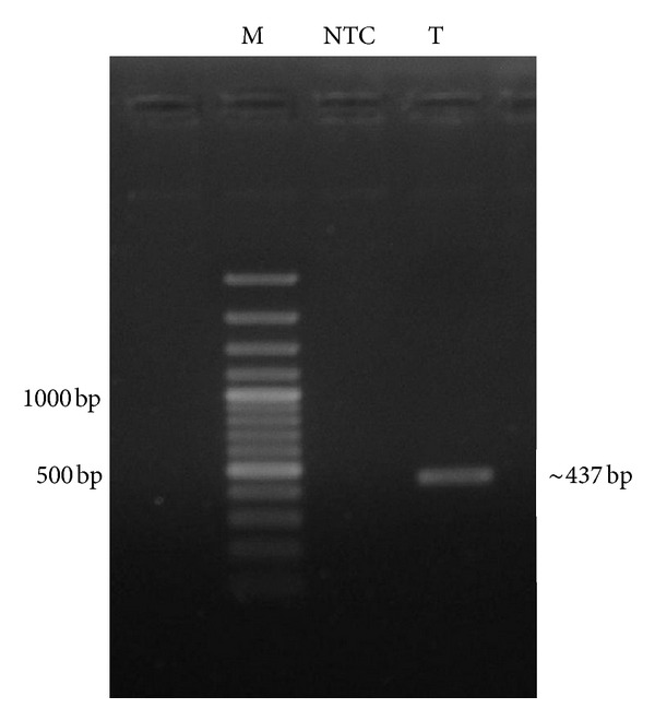 Sequence Characterization of Mitochondrial 12S rRNA Gene in Mouse Deer (Moschiola indica) for PCR-RFLP Based Species Identification.