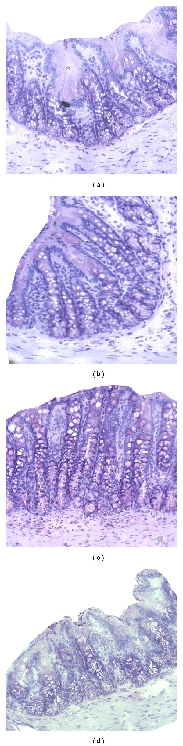 Examination of the Anti-Inflammatory, Antioxidant, and Xenobiotic-Inducing Potential of Broccoli Extract and Various Essential Oils during a Mild DSS-Induced Colitis in Rats.