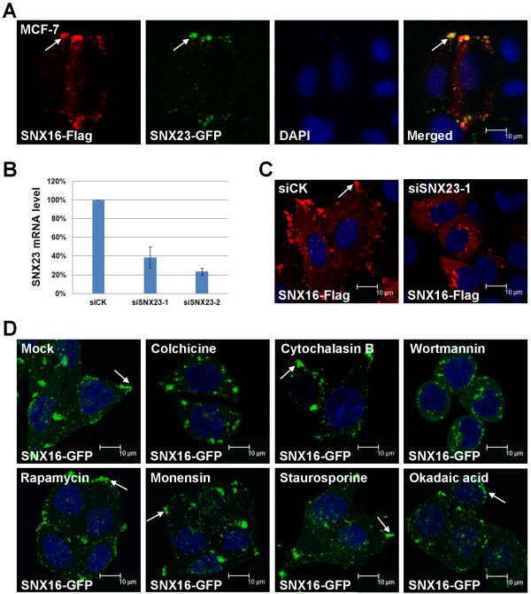 SNX16 negatively regulates the migration and tumorigenesis of MCF-7 cells