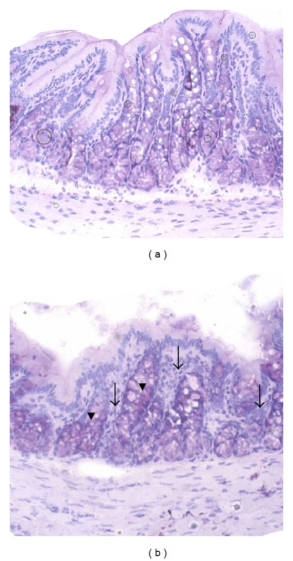 Examination of the Anti-Inflammatory, Antioxidant, and Xenobiotic-Inducing Potential of Broccoli Extract and Various Essential Oils during a Mild DSS-Induced Colitis in Rats.