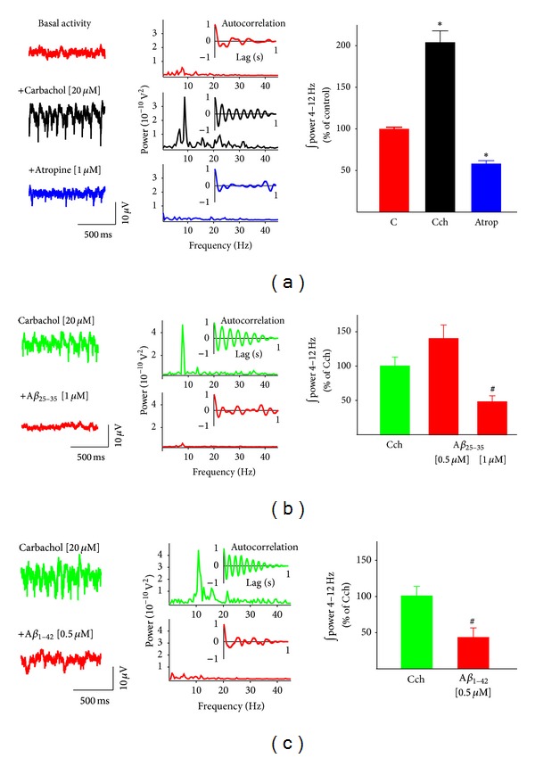 Amyloid Beta peptides differentially affect hippocampal theta rhythms in vitro.