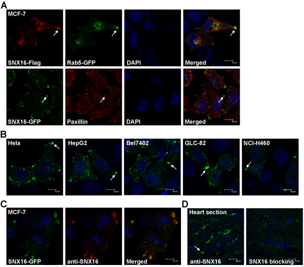 SNX16 negatively regulates the migration and tumorigenesis of MCF-7 cells