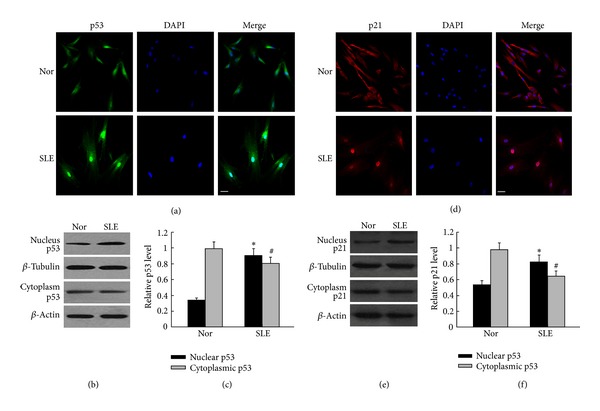 p53/p21 Pathway involved in mediating cellular senescence of bone marrow-derived mesenchymal stem cells from systemic lupus erythematosus patients.