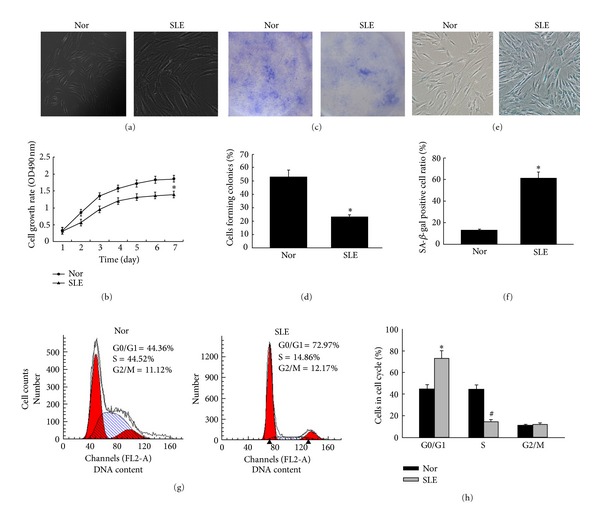 p53/p21 Pathway involved in mediating cellular senescence of bone marrow-derived mesenchymal stem cells from systemic lupus erythematosus patients.