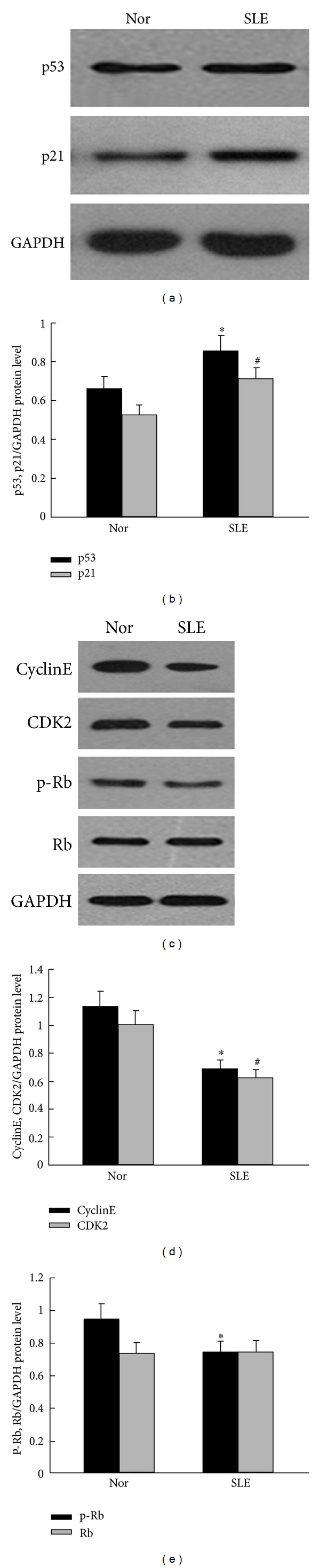 p53/p21 Pathway involved in mediating cellular senescence of bone marrow-derived mesenchymal stem cells from systemic lupus erythematosus patients.