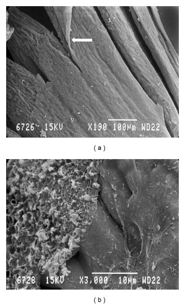 Scanning Electron Microscopic Studies of the Pecten Oculi in the Quail (Coturnix coturnix japonica).