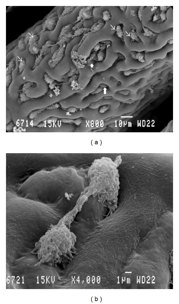 Scanning Electron Microscopic Studies of the Pecten Oculi in the Quail (Coturnix coturnix japonica).