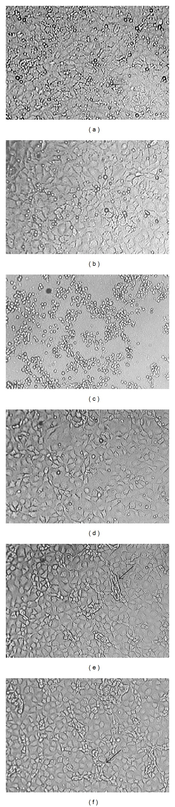 Simulation of Drug Release from PLGA Particles In Vivo.