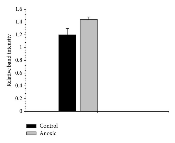 Stable Suppression of Lactate Dehydrogenase Activity during Anoxia in the Foot Muscle of Littorina littorea and the Potential Role of Acetylation as a Novel Posttranslational Regulatory Mechanism.