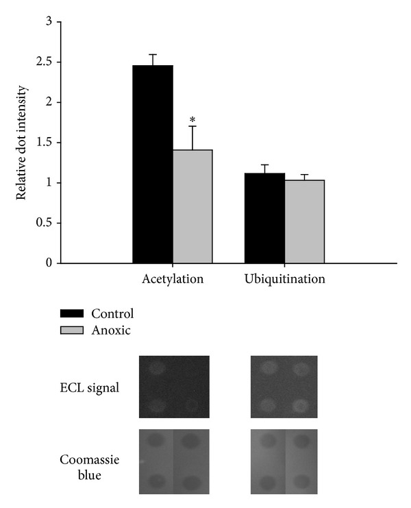 Stable Suppression of Lactate Dehydrogenase Activity during Anoxia in the Foot Muscle of Littorina littorea and the Potential Role of Acetylation as a Novel Posttranslational Regulatory Mechanism.