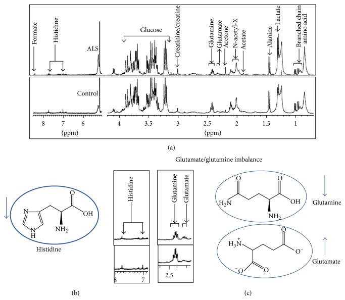 Amyotrophic Lateral Sclerosis and Metabolomics: Clinical Implication and Therapeutic Approach.