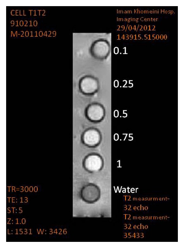 Gd(3+)-DTPA-Meglumine-Anionic Linear Globular Dendrimer G1: Novel Nanosized Low Toxic Tumor Molecular MR Imaging Agent.