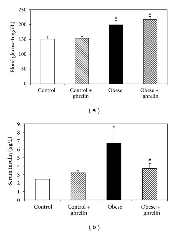 Systemic ghrelin administration alters serum biomarkers of angiogenesis in diet-induced obese mice.