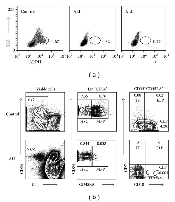 Lymphoid progenitor cells from childhood acute lymphoblastic leukemia are functionally deficient and express high levels of the transcriptional repressor Gfi-1.