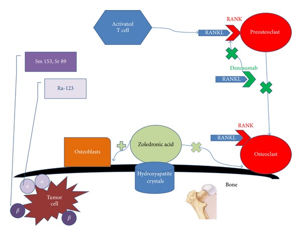 Bone-targeted therapies in metastatic castration-resistant prostate cancer: evolving paradigms.