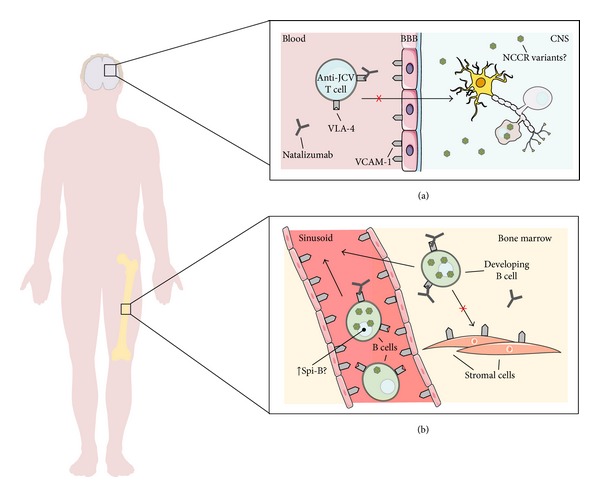 JC polyomavirus (JCV) and monoclonal antibodies: friends or potential foes?