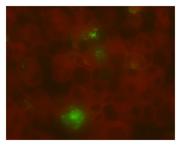 JC polyomavirus (JCV) and monoclonal antibodies: friends or potential foes?