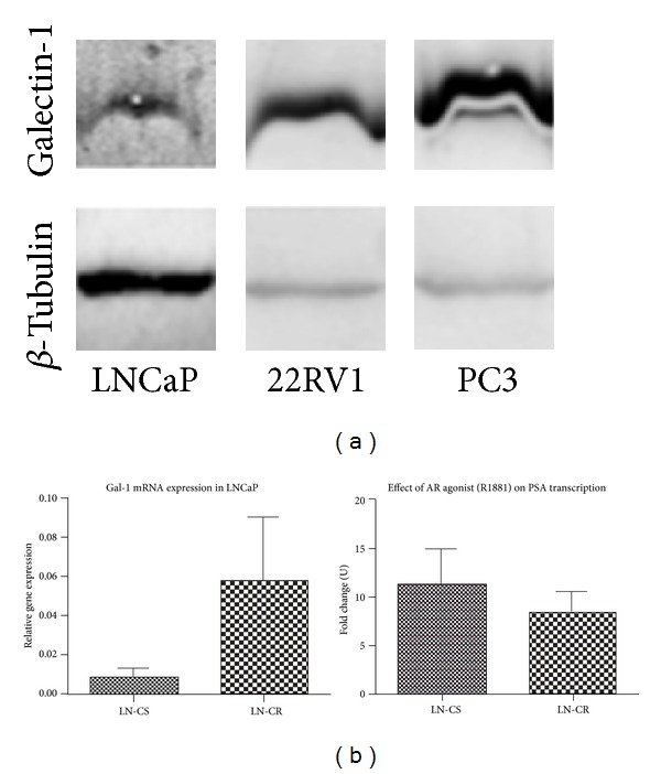 Galectins as new prognostic markers and potential therapeutic targets for advanced prostate cancers.