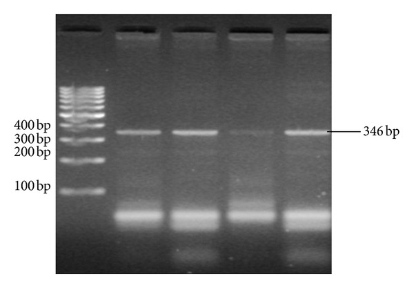 Transforming Growth Factor- β 1 Gene Polymorphism (T29C) in Egyptian Patients with Hepatitis B Virus Infection: A Preliminary Study.