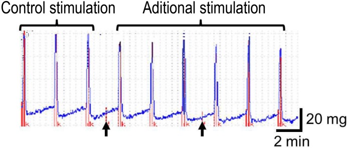 Effect of fenspiride on bronchial smooth muscle of rats with chronic obstructive pulmonary disease.