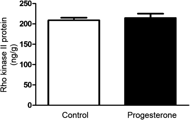 Non-genomic effects of progesterone on Rho kinase II in rat gastric smooth muscle cells.