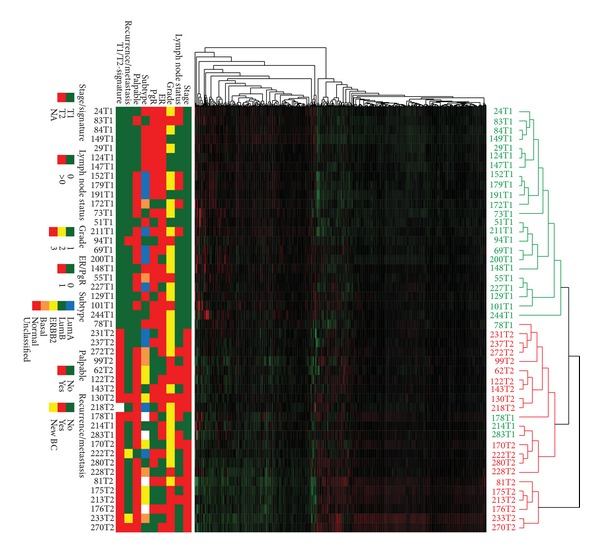 Gene expression profile analysis of t1 and t2 breast cancer reveals different activation pathways.