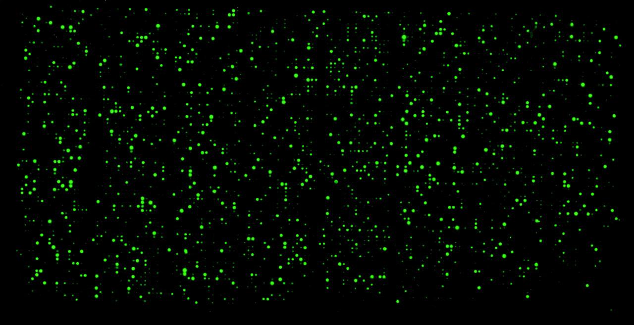 Diagnosing Male Factor Infertility Using Microarrays