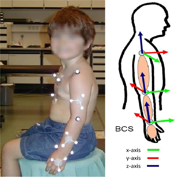 A modeling approach to compute modification of net joint forces caused by coping movements in obstetric brachial plexus palsy.