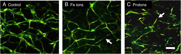 The effects of radiation on angiogenesis.