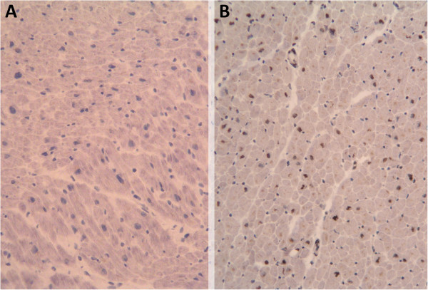 Insulin-like growth factor 1 myocardial expression decreases in chronic alcohol consumption.