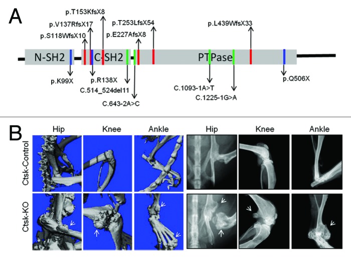 From an orphan disease to a generalized molecular mechanism: PTPN11 loss-of-function mutations in the pathogenesis of metachondromatosis.