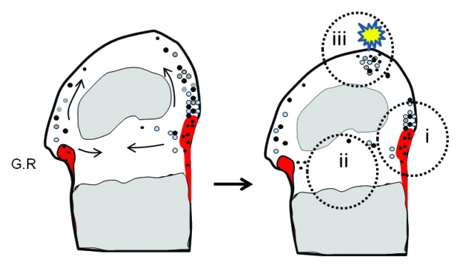 From an orphan disease to a generalized molecular mechanism: PTPN11 loss-of-function mutations in the pathogenesis of metachondromatosis.