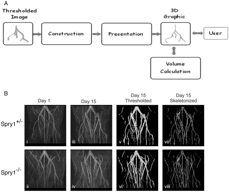 Interactive 3D Analysis of Blood Vessel Trees and Collateral Vessel Volumes in Magnetic Resonance Angiograms in the Mouse Ischemic Hindlimb Model.