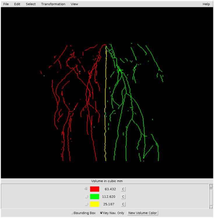 Interactive 3D Analysis of Blood Vessel Trees and Collateral Vessel Volumes in Magnetic Resonance Angiograms in the Mouse Ischemic Hindlimb Model.