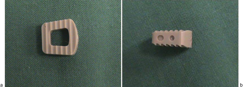 A comparison of radiostereometric analysis and computed tomography for the assessment of lumbar spinal fusion in a sheep model.