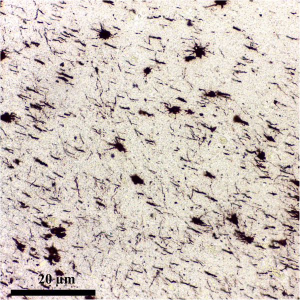 Astrocytes reassessment - an evolving concept part one: embryology, biology, morphology and reactivity.