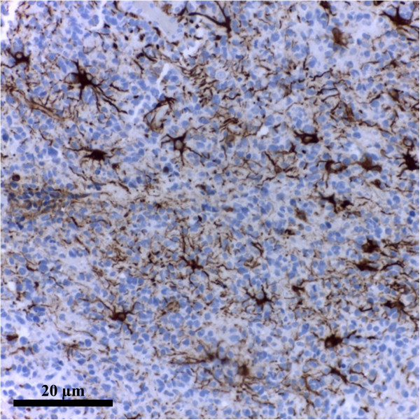 Astrocytes reassessment - an evolving concept part one: embryology, biology, morphology and reactivity.