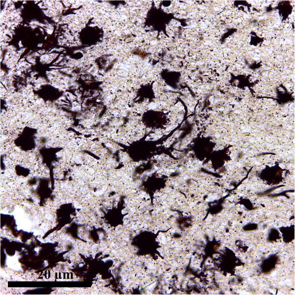 Astrocytes reassessment - an evolving concept part one: embryology, biology, morphology and reactivity.