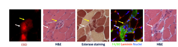 Restoration versus reconstruction: cellular mechanisms of skin, nerve and muscle regeneration compared.