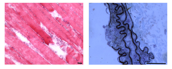 Restoration versus reconstruction: cellular mechanisms of skin, nerve and muscle regeneration compared.